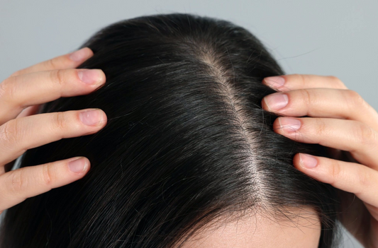 Cuir chevelu : pourquoi en prendre soin est essentiel